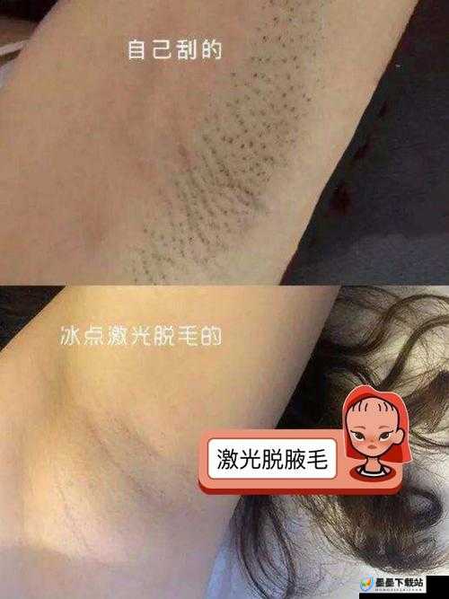 未满十八岁可以激光脱毛吗女生：探究其可行性与影响